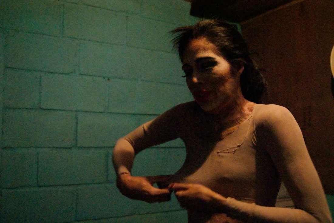 Paola cubriendo sicatriz color ©FraukeDecoodt